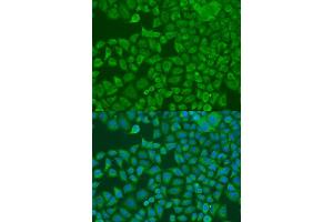 Immunofluorescence analysis of U2OS cells using FXR2 antibody.