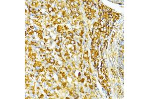 Immunohistochemistry of paraffin-embedded rat ovary using V antibody (ABIN6130774, ABIN6150046, ABIN6150047 and ABIN6224821) at dilution of 1:100 (40x lens). (VAMP1 anticorps  (AA 1-96))