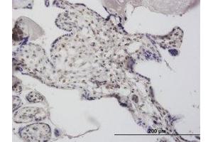 Image no. 4 for anti-Decapping Enzyme, Scavenger (DCPS) (AA 1-338) antibody (ABIN466201) (DCPS anticorps  (AA 1-338))