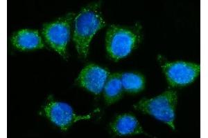 IF analysis of GPR54/KISS1R using anti-GPR54/KISS1R antibody (ABIN7602153). (KISS1R anticorps  (AA 60-373))