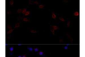 Immunofluorescence analysis of PC-12 cells using FLNA Polyclonal Antibody at dilution of 1:100 (40x lens).