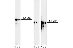 Western blot analysis of GATA3 in human T leukemia and mouse T helper cells. (GATA3 anticorps)