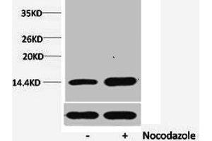 Western blot analysis of extracts from Hela cells, untreated (-) or treated, 1:5000. (HIST1H1A/HIST1H1C/HIST1H1D/HIST1H1E (pSer1) anticorps)