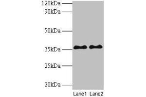 Western blot All lanes: SUPT3H antibody at 2 μg/mL Lane 1: Mouse brain tissue Lane 2: Colo320 whole cell lysate Secondary Goat polyclonal to rabbit IgG at 1/10000 dilution Predicted band size: 36, 38 kDa Observed band size: 36 kDa (SUPT3H/SPT3 anticorps  (AA 1-328))