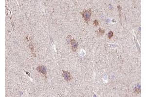 ABIN6267516 at 1/100 staining human brain tissue sections by IHC-P.