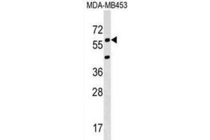 Western Blotting (WB) image for anti-Potassium Voltage-Gated Channel, Delayed-Rectifier, Subfamily S, Member 3 (KCNS3) antibody (ABIN2999385)
