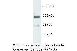 Image no. 1 for anti-Junctophilin 2 (JPH2) antibody (ABIN1112903)