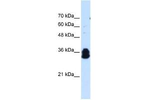 WB Suggested Anti-FAM134B Antibody Titration:  0. (FAM134B anticorps  (Middle Region))