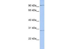WB Suggested Anti-HMX2 Antibody Titration:  0. (HMX2 anticorps  (Middle Region))