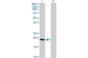Western Blot analysis of C9orf6 expression in transfected 293T cell line by C9orf6 MaxPab polyclonal antibody.