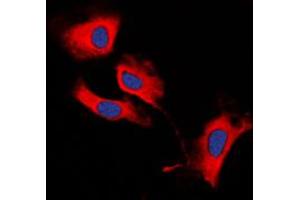 Immunofluorescent analysis of MMP13 staining in HeLa cells.