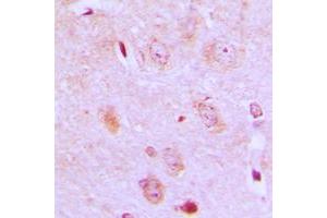Immunohistochemical analysis of IARS2 staining in human brain formalin fixed paraffin embedded tissue section. (IARS2 anticorps  (N-Term))