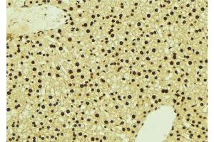 ABIN6277124 at 1/100 staining Mouse liver tissue by IHC-P. (NDRG1 anticorps  (C-Term))
