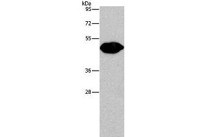 Western Blot analysis of Mouse brain tissue using PLIN2 Polyclonal Antibody at dilution of 1:680