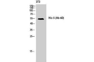 Western Blotting (WB) image for anti-Transforming Growth Factor beta 1 Induced Transcript 1 (TGFB1I1) (Tyr1586) antibody (ABIN3175482) (TGFB1I1 anticorps  (Tyr1586))