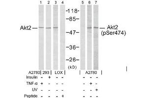 Image no. 2 for anti-V-Akt Murine Thymoma Viral Oncogene Homolog 2 (AKT2) (pSer474) antibody (ABIN196826) (AKT2 anticorps  (pSer474))