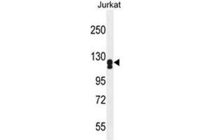 ADCY2 Antibody (Center) western blot analysis in Jurkat cell line lysates (35 µg/lane). (ADCY2 anticorps  (Middle Region))