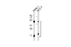 All lanes : Anti-Cathepsin D LC Antibody at 1:1000 dilution Lane 1: NC-1 whole cell lysates Lane 2: MCF-7 whole cell lysates Lysates/proteins at 20 μg per lane. (Cathepsin D anticorps  (Light Chain))