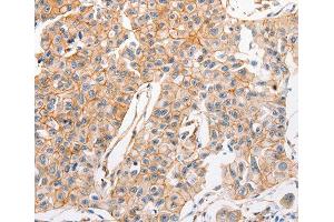 Immunohistochemistry (IHC) image for anti-ATP-Binding Cassette, Sub-Family C (CFTR/MRP), Member 1 (ABCC1) antibody (ABIN3017211)