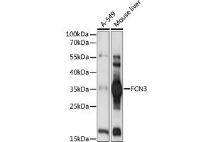anti-Ficolin (Collagen/fibrinogen Domain Containing) 3 (Hakata Antigen) (FCN3) (AA 13-288) antibody