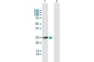 Western Blot analysis of ETHE1 expression in transfected 293T cell line by ETHE1 MaxPab polyclonal antibody. (ETHE1 anticorps  (AA 1-254))