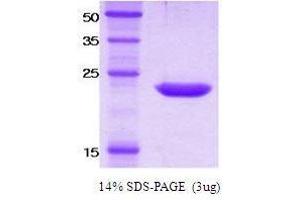 Figure annotation denotes ug of protein loaded and % gel used.