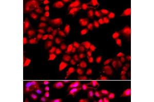 Immunofluorescence analysis of A549 cells using KU70 Polyclonal Antibody