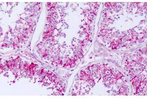 Image no. 1 for anti-Repetin (RPTN) (C-Term) antibody (ABIN6749795)
