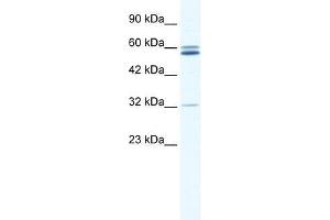 Western Blot showing ZNF491 antibody used at a concentration of 1-2 ug/ml to detect its target protein. (ZNF491 anticorps  (N-Term))