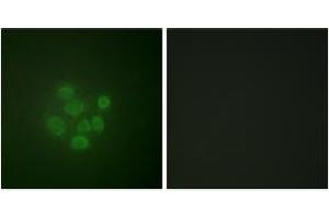 Immunofluorescence analysis of A549 cells, using MDM2 (Phospho-Ser166) Antibody.
