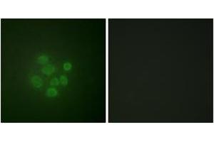 Immunofluorescence analysis of A549 cells, using MDM2 (Phospho-Ser166) Antibody. (MDM2 anticorps  (pSer166))