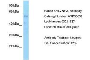 Image no. 1 for anti-Zinc Finger Protein 20 (ZNF20) (AA 449-498) antibody (ABIN6749920) (ZNF20 anticorps  (AA 449-498))