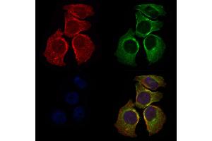 ABIN6265123 and ABIN6276491 staining HepG2 cells by IF/ICC.
