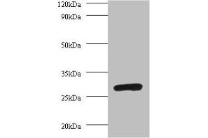 Western blot All lanes: PSMA7 antibody at 2 μg/mL + 293T whole cell lysate Secondary Goat polyclonal to rabbit IgG at 1/10000 dilution Predicted band size: 28, 21, 17 kDa Observed band size: 28 kDa (PSMA7 anticorps  (AA 5-232))