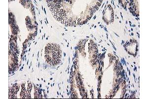 Image no. 10 for anti-UDP-Galactose-4-Epimerase (GALE) antibody (ABIN1498366) (GALE anticorps)