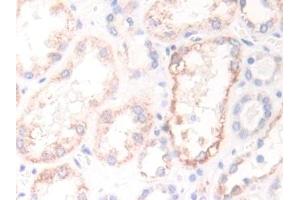Detection of ECH1 in Human Kidney Tissue using Polyclonal Antibody to Enoyl Coenzyme A Hydratase 1, Peroxisomal (ECH1)