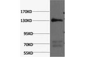 Western Blotting (WB) image for anti-Nitric Oxide Synthase 3 (Endothelial Cell) (NOS3) antibody (ABIN5961404) (ENOS anticorps)