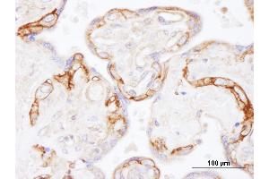 Immunohistochemistry (IHC) image for anti-Epidermal Growth Factor Receptor (EGFR) (AA 1100-1150) antibody (ABIN7454623) (EGFR anticorps  (AA 1100-1150))