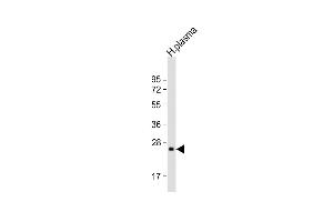 Anti-CFD Antibody (N-term)at 1:2000 dilution + human plasma lysates Lysates/proteins at 20 μg per lane. (Adipsin anticorps  (N-Term))