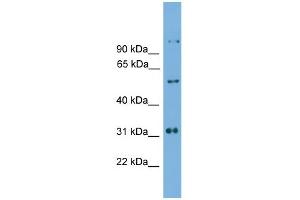 WB Suggested Anti-Irx2 Antibody Titration: 0. (IRX2 anticorps  (C-Term))
