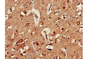 Immunohistochemistry of paraffin-embedded human brain tissue using ABIN7144364 at dilution of 1:100