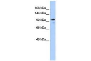 Image no. 1 for anti-Angiomotin Like 1 (AMOTL1) (AA 144-193) antibody (ABIN6740787) (AMOTL1 anticorps  (AA 144-193))