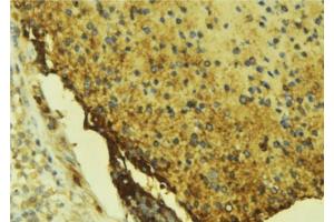 ABIN6276681 at 1/100 staining Mouse liver tissue by IHC-P.