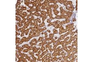 Immunohistochemical staining of human liver with SLC38A9 polyclonal antibody  shows strong cytoplasmic positivity in hepatocytes. (SLC38A9 anticorps)