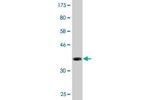 Western Blot detection against Immunogen (36. (ABLIM1 anticorps  (AA 637-736))