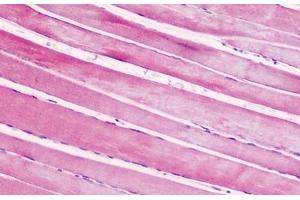 Human, Skeletal muscle: Formalin-Fixed Paraffin-Embedded (FFPE) (CRHR2 anticorps  (AA 71-120))