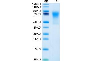 Human DcR1/TRAILR3 on Tris-Bis PAGE under reduced condition. (DcR1 Protein (AA 24-236) (His tag))