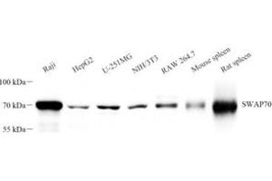 Western blot analysis of SWAP70 (ABIN7075775) at dilution of 1: 2000 (SWAP70 anticorps)