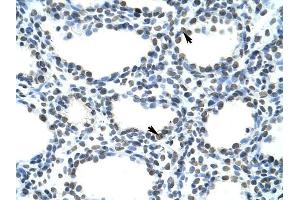 SFRS10 antibody was used for immunohistochemistry at a concentration of 4-8 ug/ml to stain Alveolar cells (arrows) in Human Lung. (TRA2B anticorps)