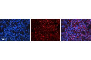 Rabbit Anti-CCND3 Antibody  AV Formalin Fixed Paraffin Embedded Tissue: Human Lymph Node Tissue Observed Staining: Cytoplasm Primary Antibody Concentration: 1:600 Other Working Concentrations: N/A Secondary Antibody: Donkey anti-Rabbit-Cy3 Secondary Antibody Concentration: 1:200 Magnification: 20X Exposure Time: 0.